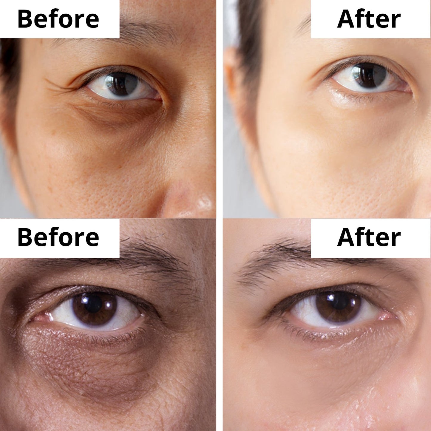 dermaset